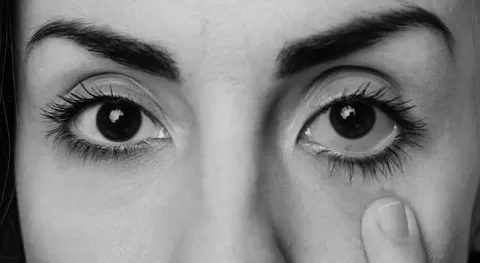 干眼症延误治疗现象普遍，早期干预可避免炎症恶性循环-第1张图片-