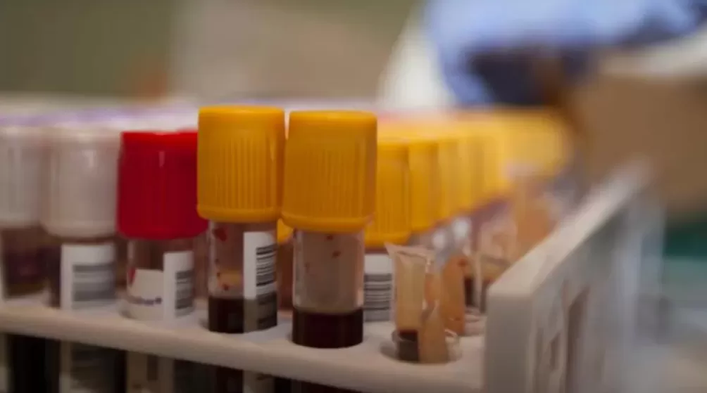 超一亿人处于危险之中,它被称为新的艾滋病-第5张图片- 超一亿人处于危险之中,它被称为新的艾滋病-第5张图片-