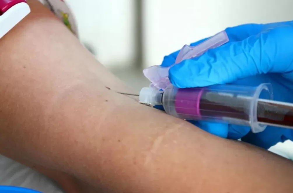 超一亿人处于危险之中,它被称为新的艾滋病-第4张图片- 超一亿人处于危险之中,它被称为新的艾滋病-第4张图片-