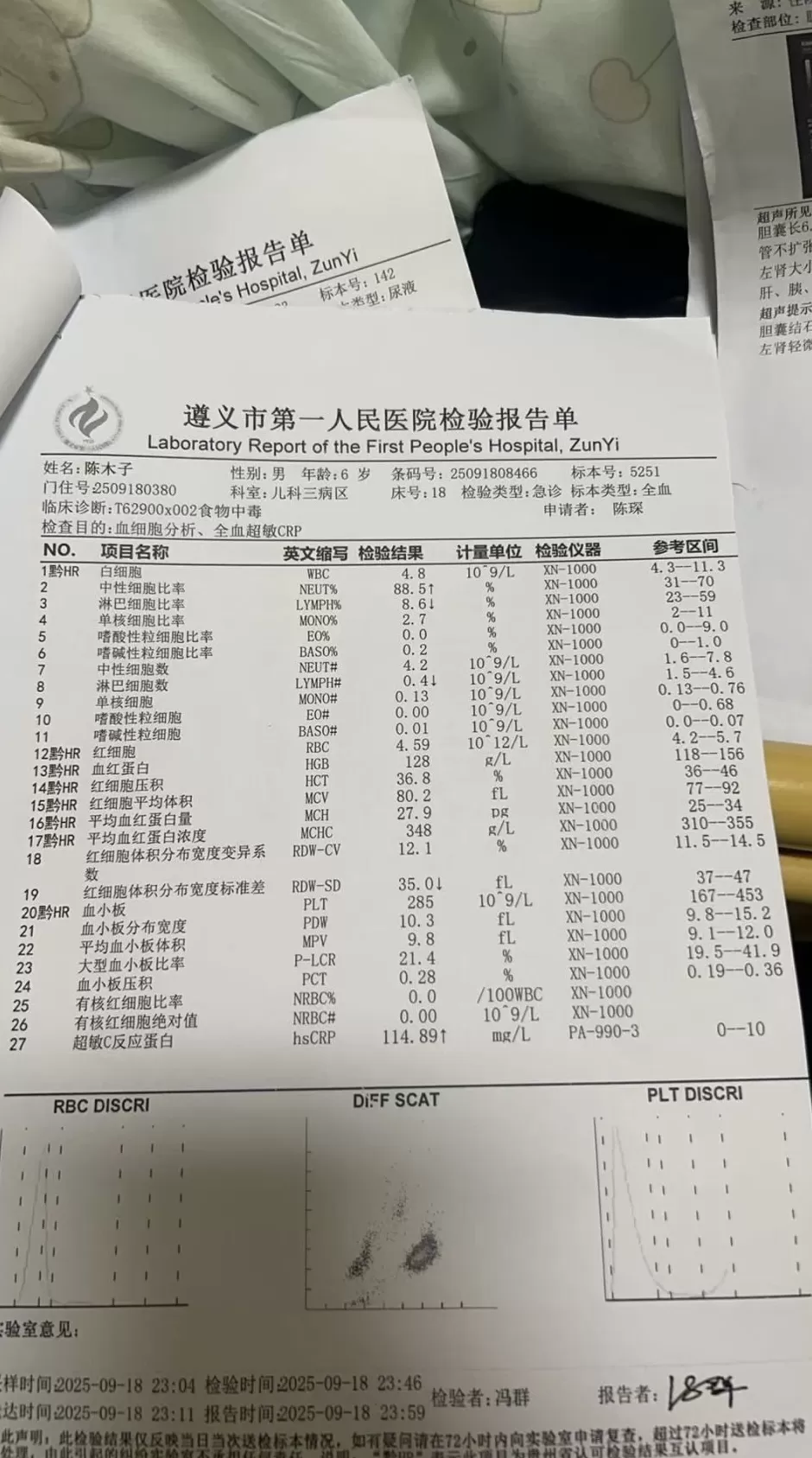 贵州多名小孩食用蛋糕后上吐下泻，当地政府要求家长删视频-第2张图片-