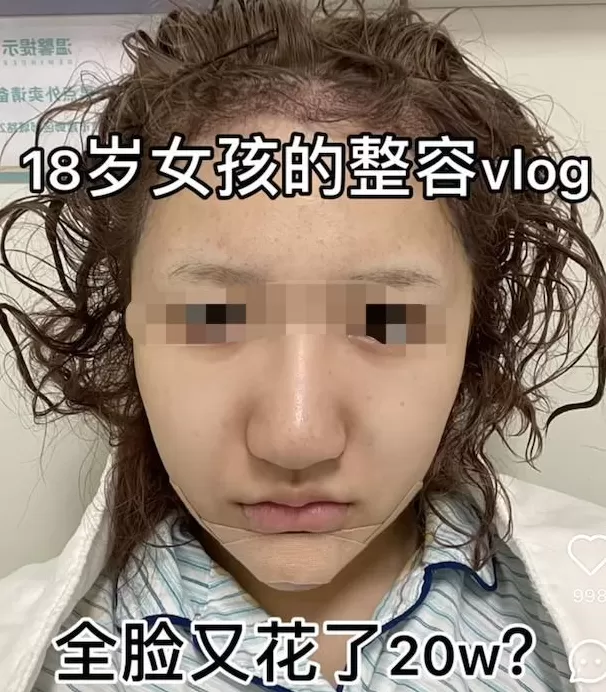 医美行业，坑了多少女大学生？-第1张图片-