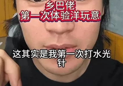 医美行业，坑了多少女大学生？-第6张图片-