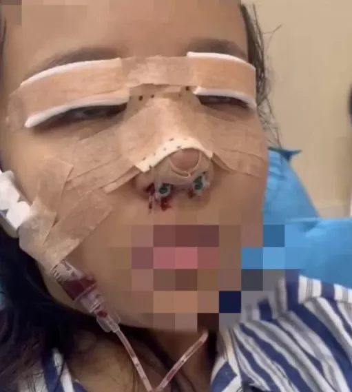 医美行业，坑了多少女大学生？-第18张图片-