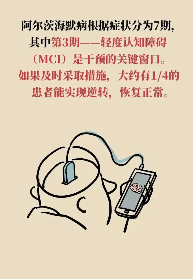 阿尔茨海默病可潜伏20年,抓住“黄金干预期”能逆转-第14张图片- 阿尔茨海默病可潜伏20年,抓住“黄金干预期”能逆转-第14张图片-