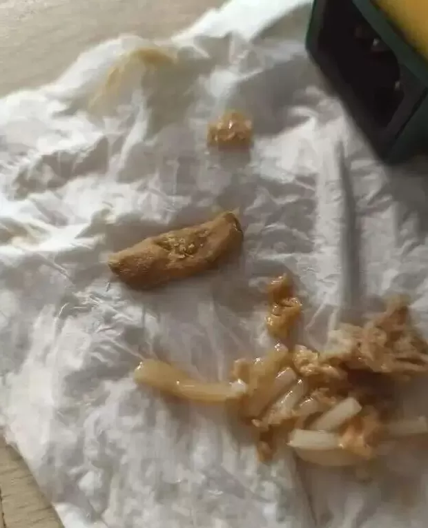 “恶心得想吐”，知名品牌螺狮粉被曝吃出脚指甲、烟头等异物，客服回应：生产流程均经过严格质检-第1张图片-