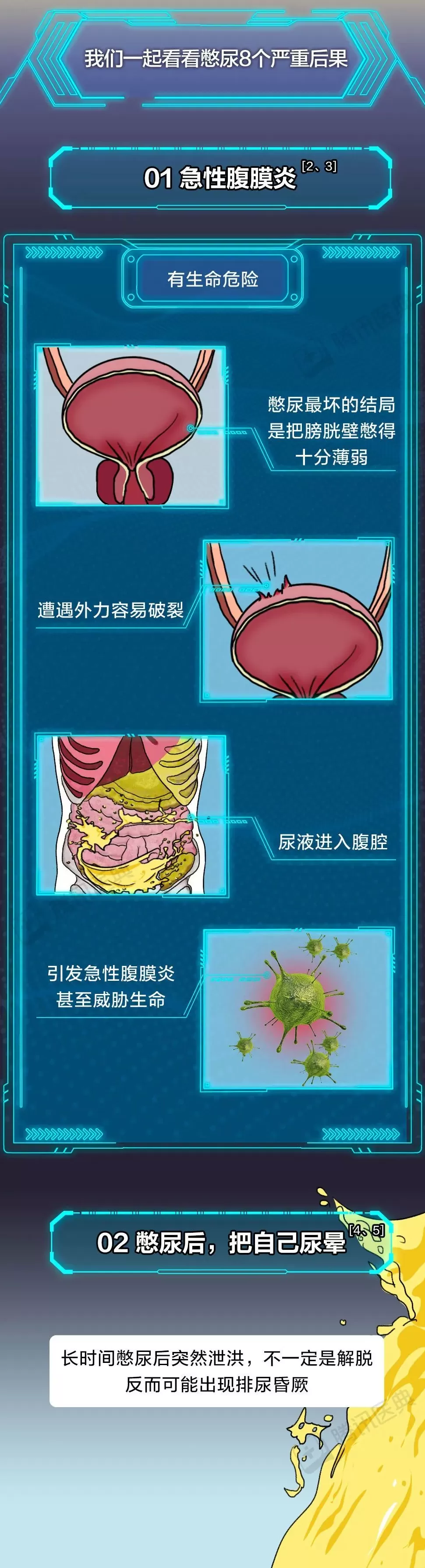 膀胱最怕的这件事，你可能每天都在做-第9张图片-