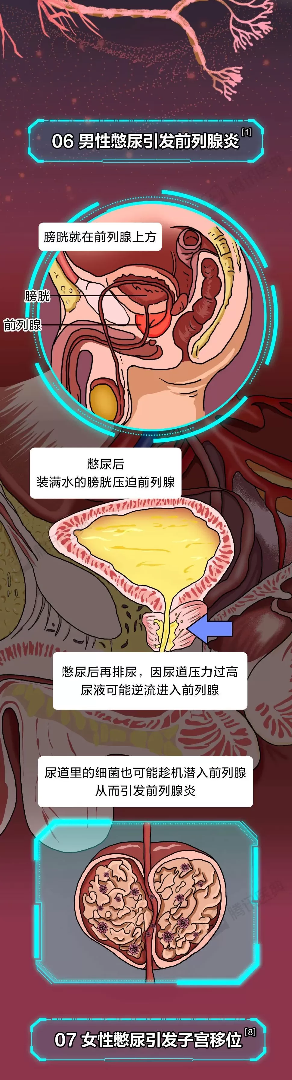 膀胱最怕的这件事，你可能每天都在做-第13张图片-