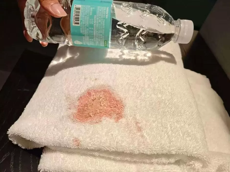 男子在成都一酒店使用浴巾发现大片血迹，担心染病要求赔偿，酒店质疑对方敲诈：客人可请机构上门取样送检-第1张图片-