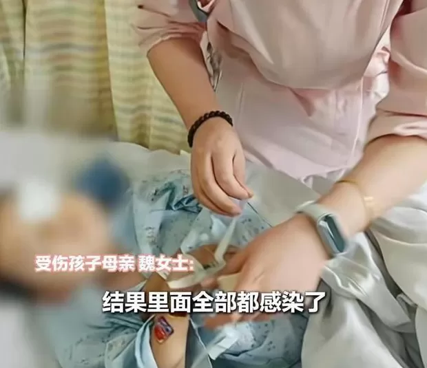 江西一5岁男孩在幼儿园被戳伤致左眼失明，家长称老师用猪油涂抹试图消肿-第1张图片-