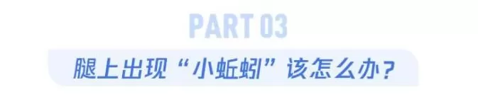 腿上出现“小蚯蚓”，别不当回事，可能被这种病盯上了-第13张图片-