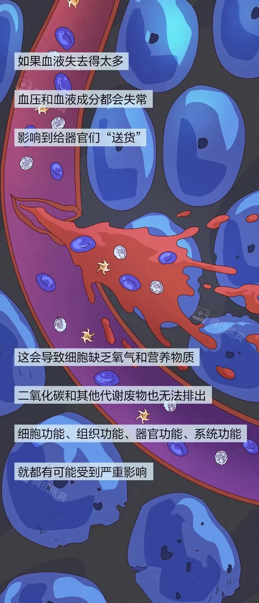 出血一旦止不住，到底有多可怕？-第8张图片-