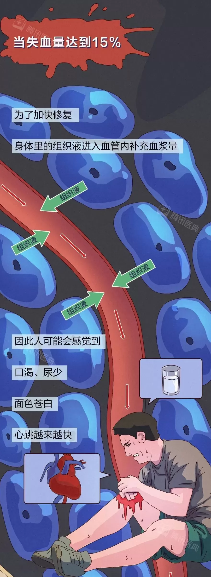 出血一旦止不住，到底有多可怕？-第11张图片-