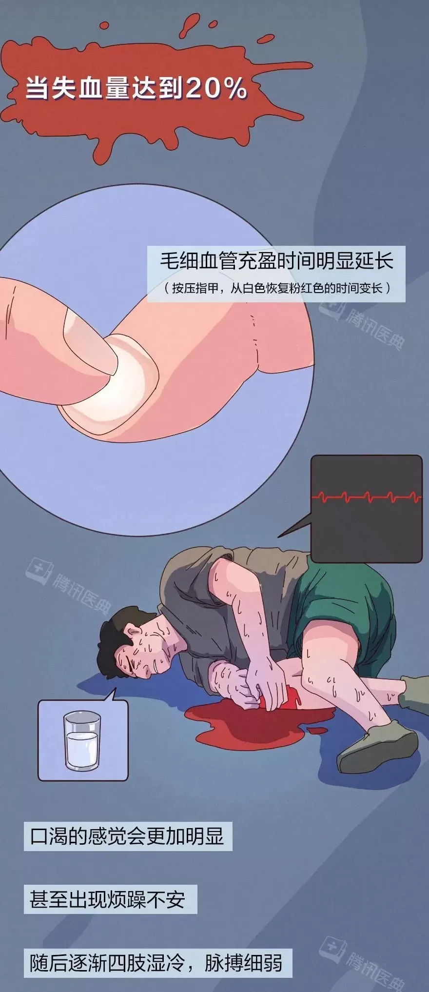 出血一旦止不住，到底有多可怕？-第13张图片-