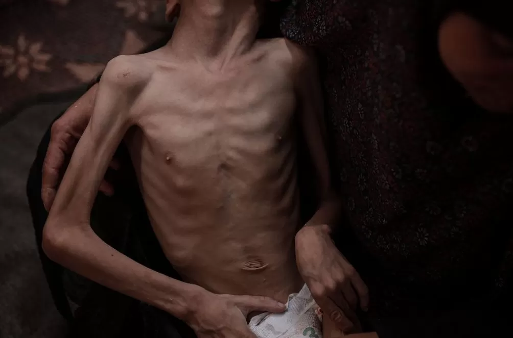 图说｜世界粮食日：援助资金减少致近1400万人陷入饥饿-第2张图片-