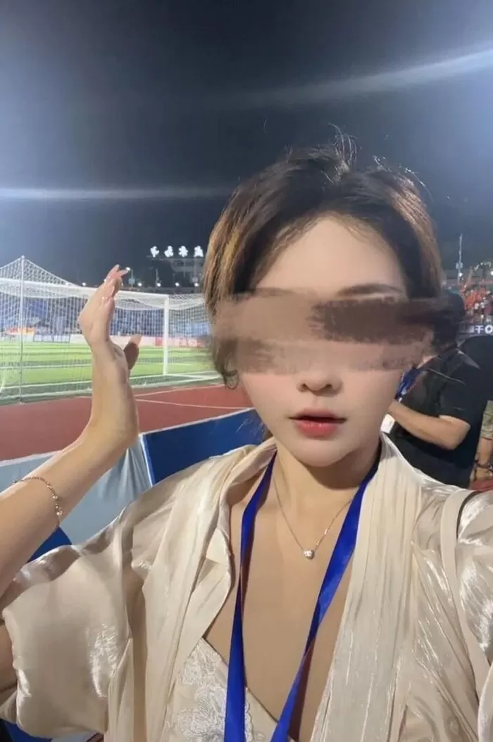 女主播被伪装包裹炸伤，当事人：面部深二度烧伤，眼睛肿得只有一条缝-第4张图片-