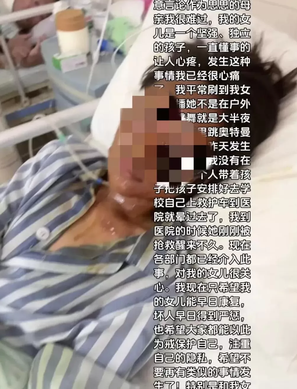 女主播称被家门口的快递包裹炸伤，监控显示一戴帽男子曾出现，警方回应-第5张图片-