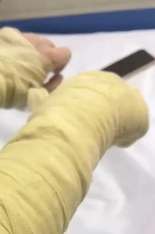 女主播称遭“炸弹包裹”袭击，面部及手臂严重炸伤！警方通报：刘某强，刑拘-第3张图片-