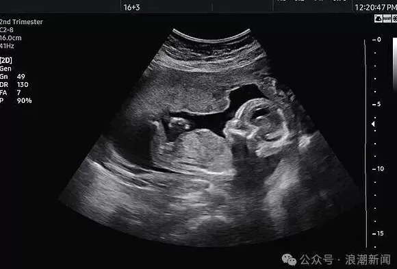 偷偷用“粉蓝”相框暗示胎儿性别，上海一家孕婴摄影店被端-第3张图片-