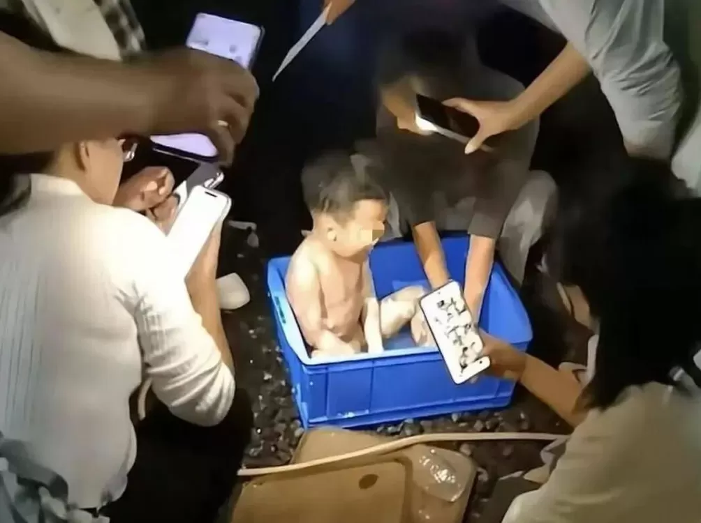 3岁男童不慎掉进炭火堆，全身85%烧伤，母亲徒手救出-第4张图片-