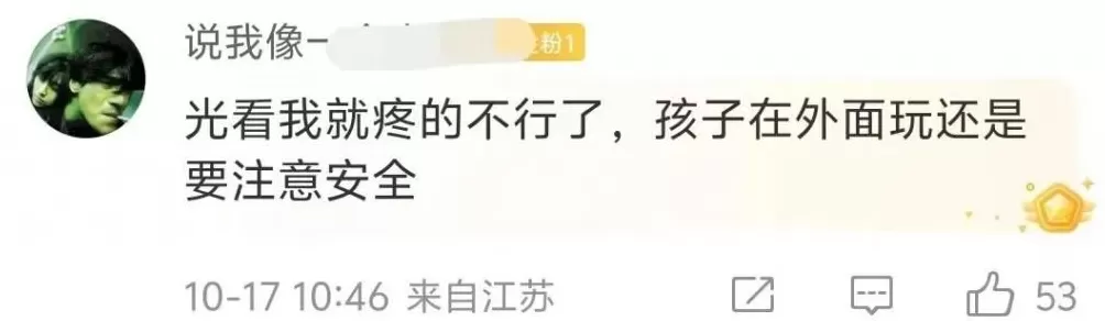 3岁男童不慎掉进炭火堆，全身85%烧伤，母亲徒手救出-第7张图片-