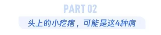 头皮抠出 “小米粒”？快住手，这几种情况要去看皮肤科-第6张图片-