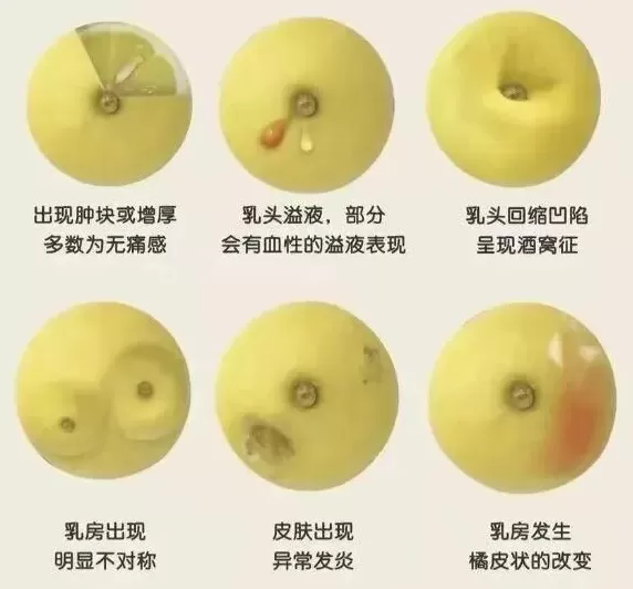 为乳腺癌义演，他们居然唱了首“我的胸臀真火辣”-第6张图片-