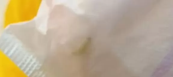 苏菲安心裤被曝拆出活虫-第1张图片-