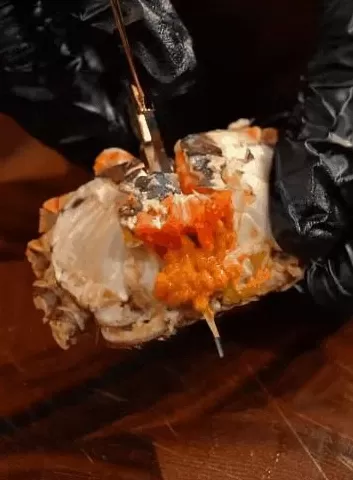 第1批狂吃螃蟹的美女，住院了-第7张图片-