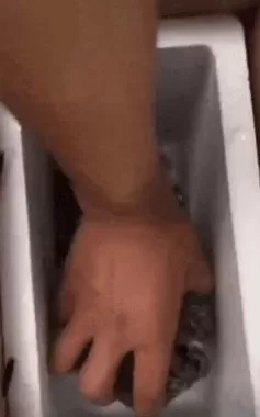 第1批狂吃螃蟹的美女，住院了-第3张图片-
