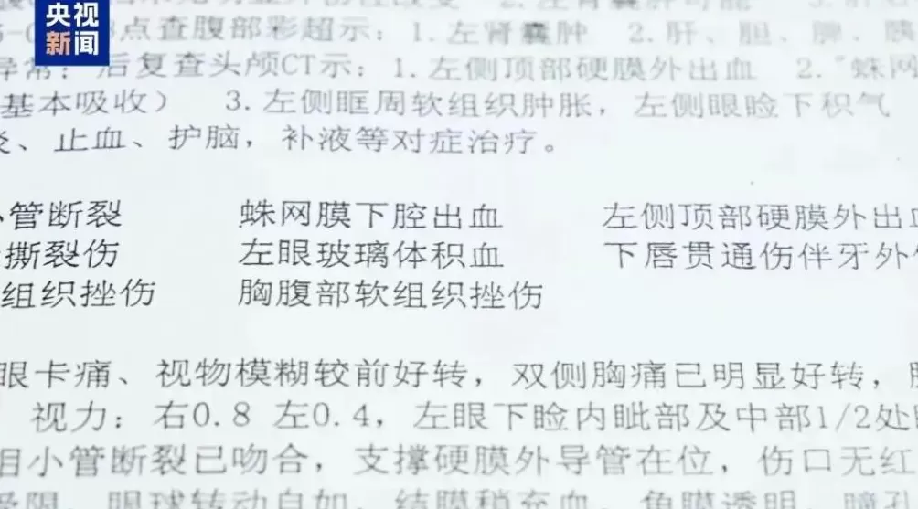 好意让同事搭便车，却发生车祸致其受伤，车主要赔偿吗？-第1张图片-