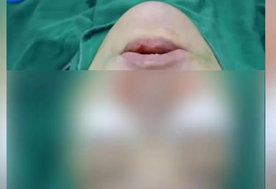 男子把钱交给女友保管，结果女友花了200多万在脸上！男友崩溃了-第3张图片-