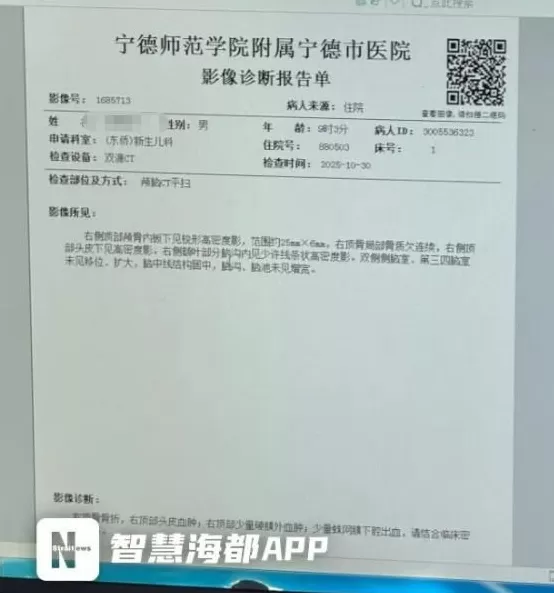 福建宁德一新生儿从医院推车坠落，致右顶骨骨折，院方回应-第4张图片-