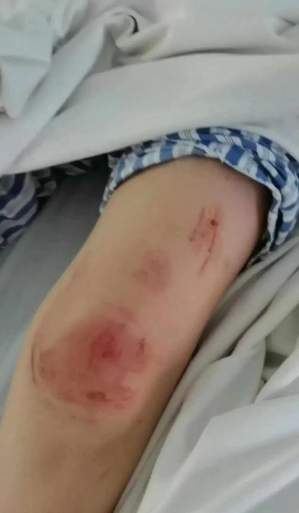 河北女子遭家暴驾车逃跑致丈夫死亡案开庭，女子父亲：她被扒光衣服遭持刀威胁，逃命还能逃出罪来-第1张图片-