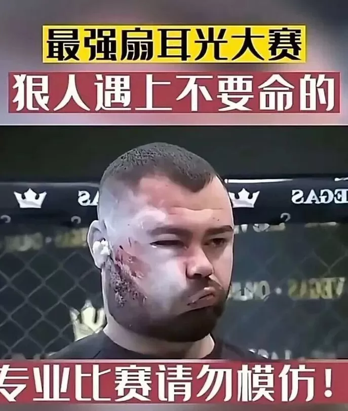 扇耳光大赛赵鸿刚输了，传统武术到底能不能打？-第7张图片-