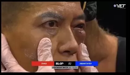 通背拳传人被几个耳光KO了，算不算传武的至暗时刻？-第5张图片-