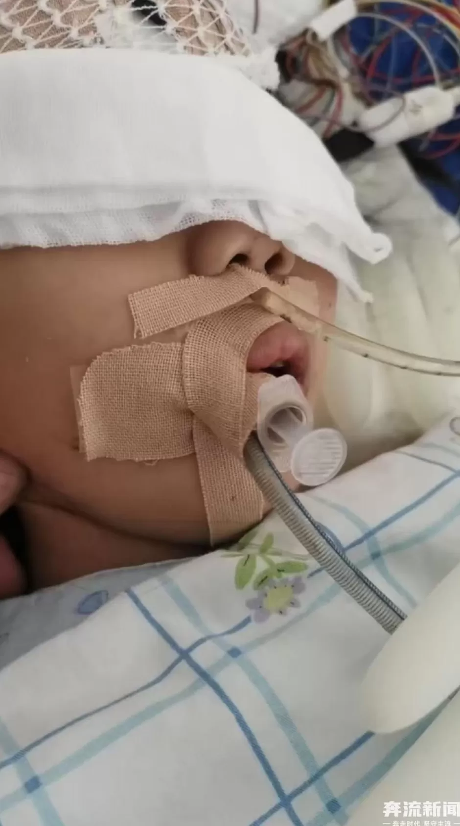 9岁女童术后成了植物人，河南省人民医院多科室医护人员篡改病历，被立案-第1张图片-