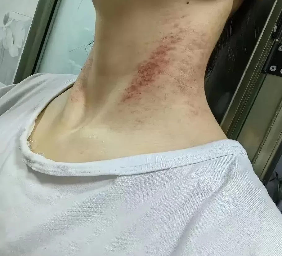 从家暴到割喉，女护士5年的“漫长死亡”-第3张图片-