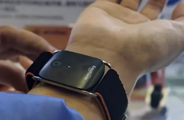 手环“电击续命”，有人已被烧伤-第2张图片-