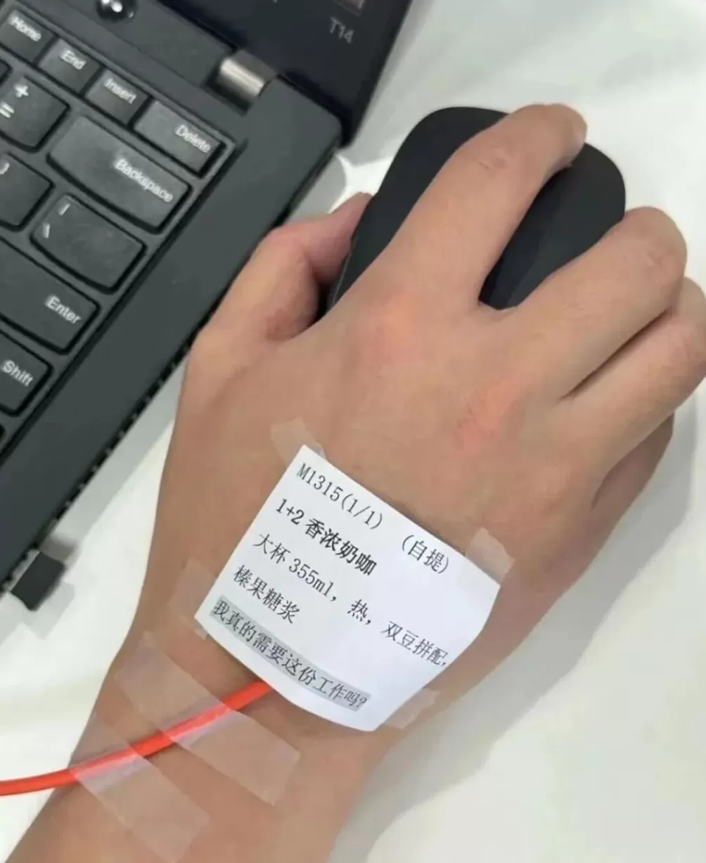 手环“电击续命”，有人已被烧伤-第7张图片-