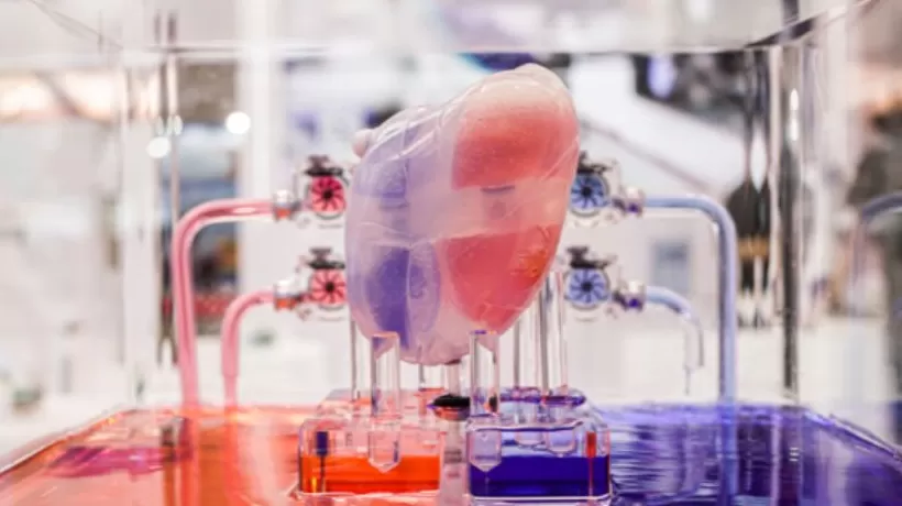 IPO雷达|“人工心脏”价格走低，核心医疗产品商业化难题待解-第1张图片-