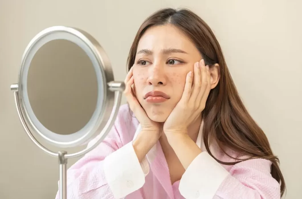 警报！你的脸蛋是否正在启动“秋冬崩盘”模式？-第2张图片-