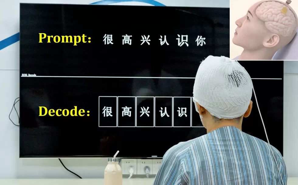 用脑机接口意念操控游戏,“人体最难传感器”如何实现一步步突破?-第3张图片- 用脑机接口意念操控游戏,“人体最难传感器”如何实现一步步突破?-第3张图片-