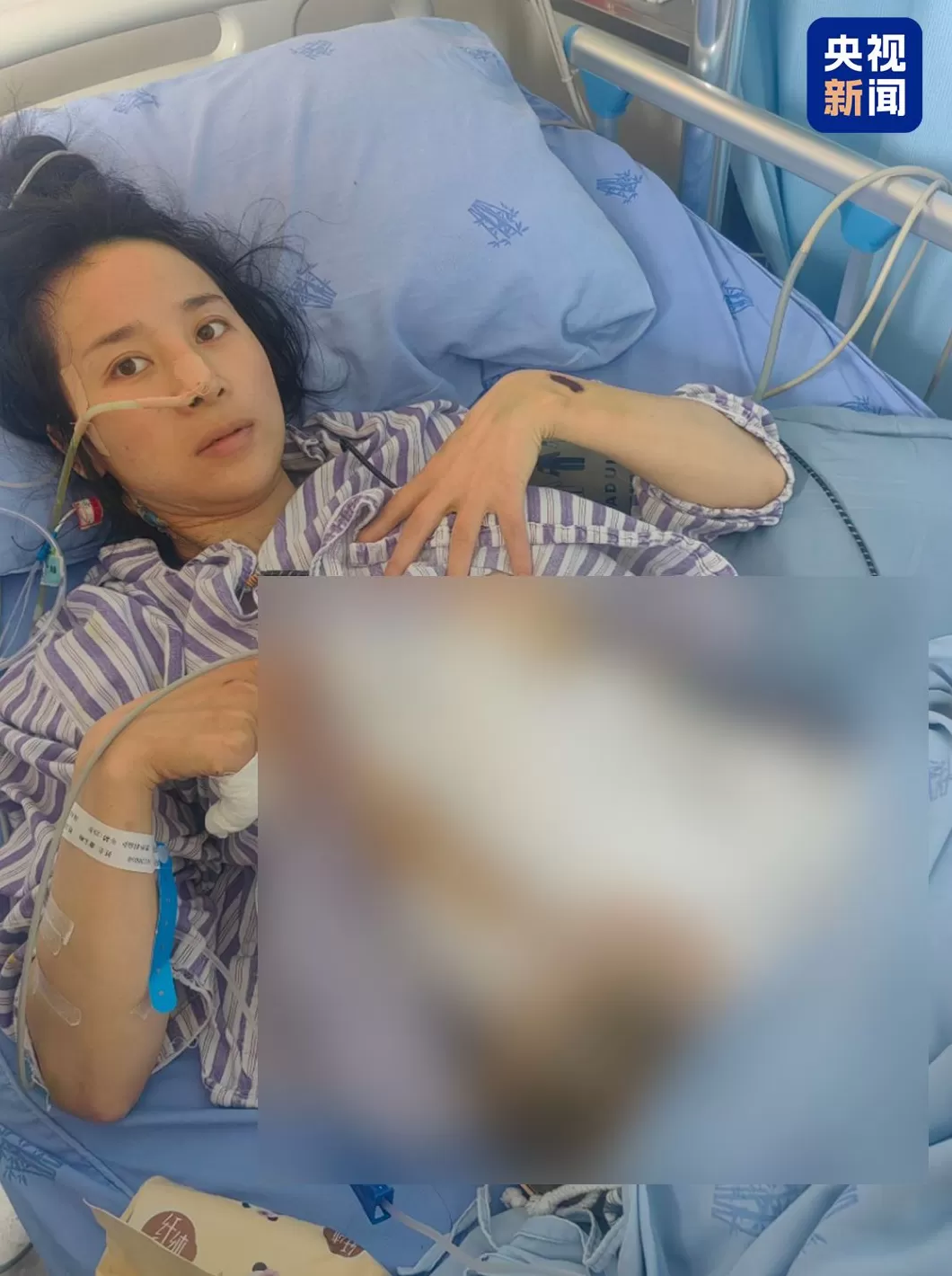 专访丨两年被家暴16次，4处重伤！受害者是否走出阴霾？-第5张图片-