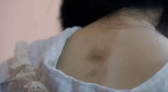 专访丨两年被家暴16次，4处重伤！受害者是否走出阴霾？-第7张图片-